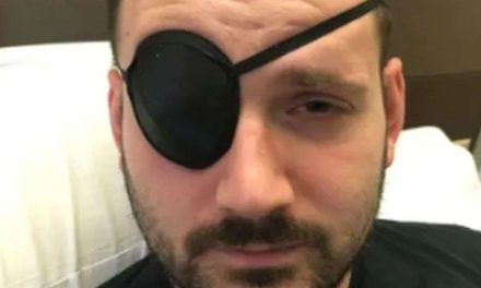 Estirar el cuello le provoca derrame cerebral