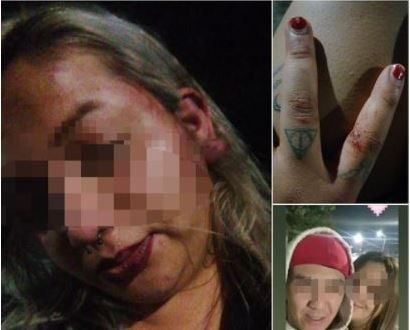 ‘Me quiere cortar en pedacitos’ Denuncia mujer intento de feminicidio en Saltillo