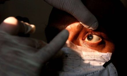 Descartan caso de infección por ‘hongo negro’ en paciente de Edomex