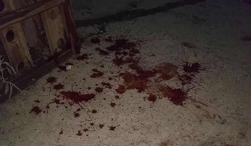 Queda grave tras recibir un balazo