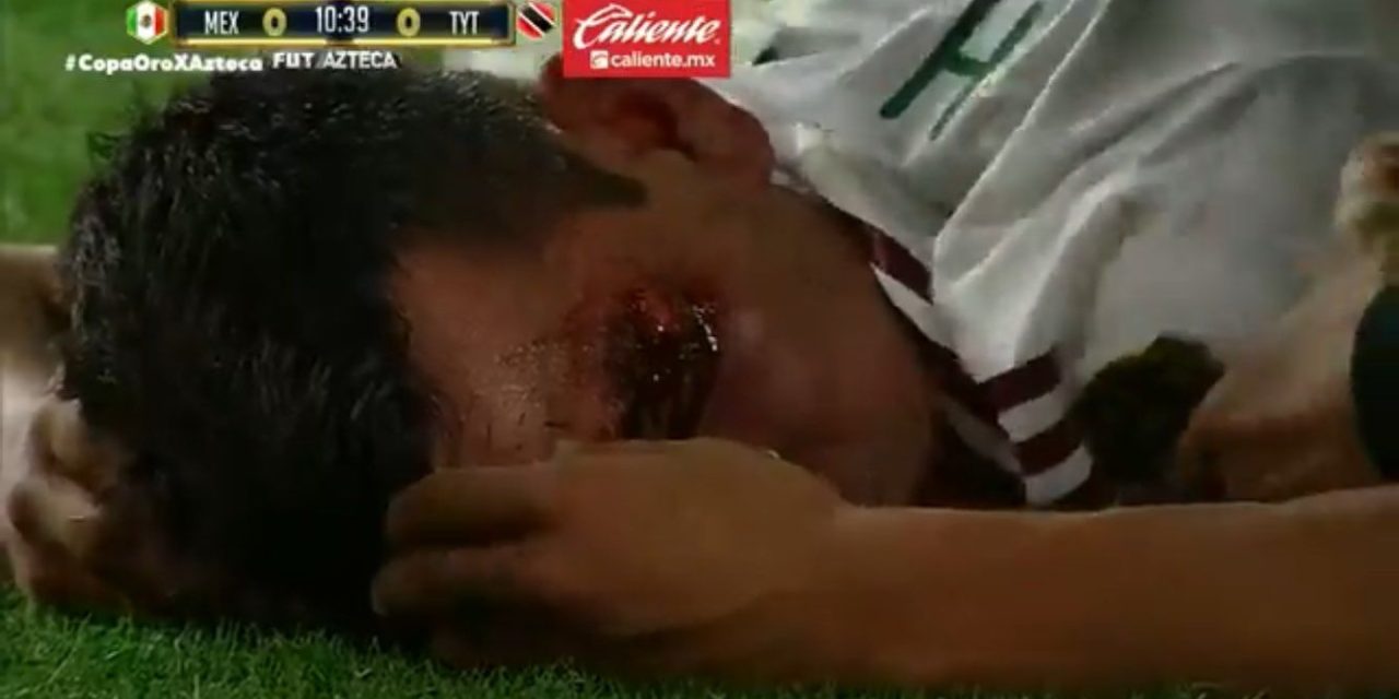 La impactante lesión del ‘Chucky’ Lozano en el juego contra Trinidad y Tobago en Copa Oro