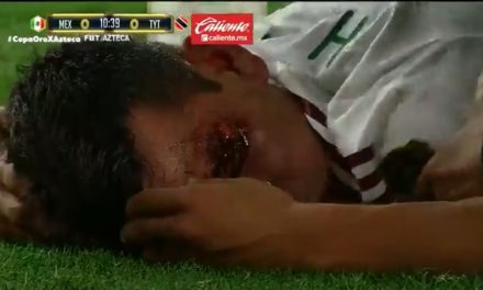 La impactante lesión del ‘Chucky’ Lozano en el juego contra Trinidad y Tobago en Copa Oro