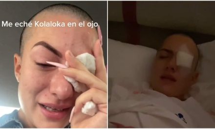 VIDEO: ¿Quién confunde un Kola Loka con gotas para los ojos? Ve lo que le pasó a esta Tik Toker