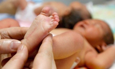 Nace bebé con el feto de su hermano pegado al estómago