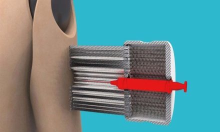 ¿Le tienes pavor a las agujas? Esta podría ser tu solución