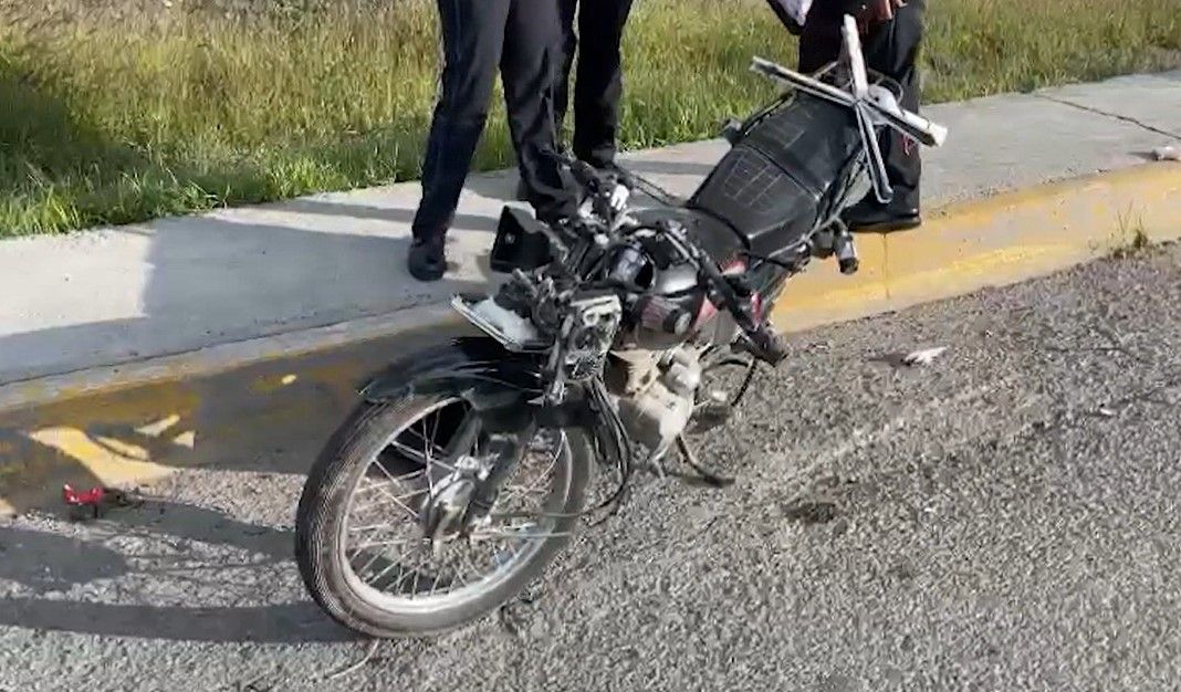 Motociclista se amputa la oreja en accidente