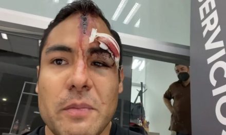 Golpean brutalmente con pistola a ex-colaborador de programa ‘Hoy’