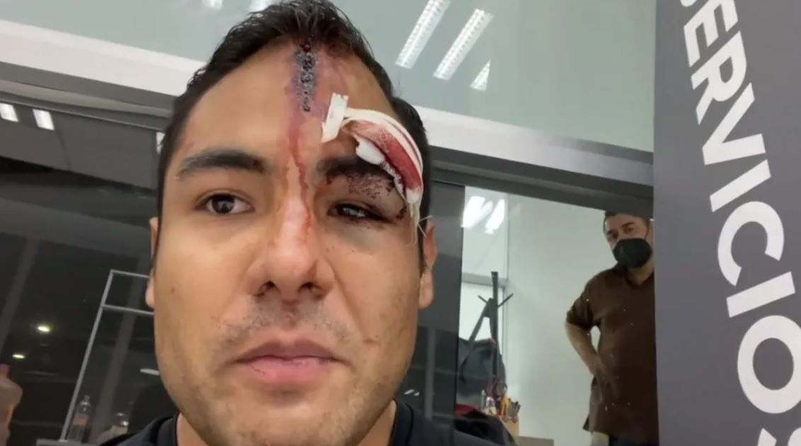 Golpean brutalmente con pistola a ex-colaborador de programa ‘Hoy’