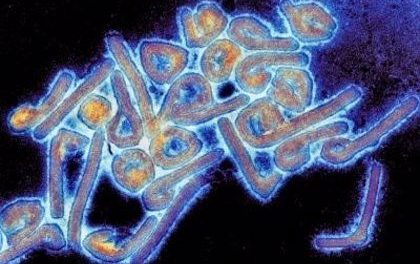 ¿Qué es el virus de Marburgo y por qué preocupa?