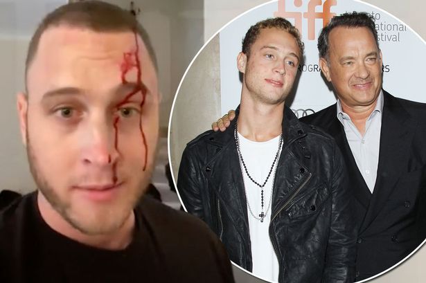 Chester Hanks, el hijo de Tom Hanks acusado de violencia y drogas