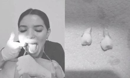 ¡Se extrae sola las muelas del juicio!; habilidosa dentista se vuelve viral (video)