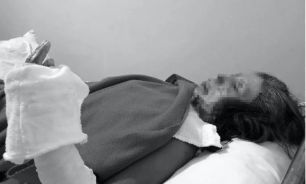 Olivia, mujer quemada con aceite y ácido quiere que su agresor vea las consecuencias