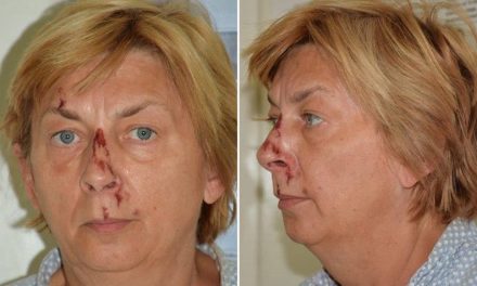 Mujer es hallada en una isla poblada por osos en Croacia; no sabe cómo llegó ahí