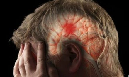 Reconoce un derrame cerebral