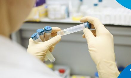 ¿Le urge su prueba covid? en una hora usted puede tener sus resultados en VIMSA Labs