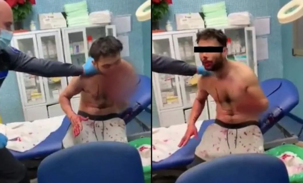 ‘Se come a a sí mismo’ luego de consumir droga caníbal en España (video)