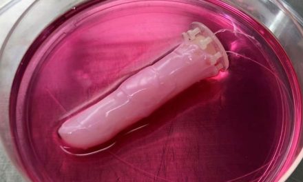 Científicos logran crear dedo robótico con ‘piel humana viva’