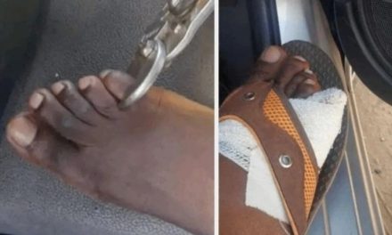 En África venden dedos de pie a 40 mil dólares para brujería