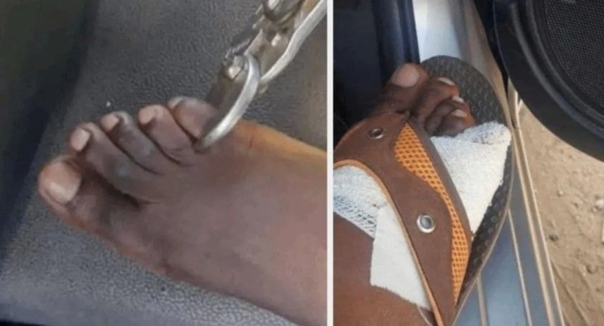 En África venden dedos de pie a 40 mil dólares para brujería