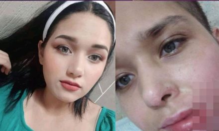 A Liliana la quemaron y abusaron tres hombres en Nuevo León, exige justicia