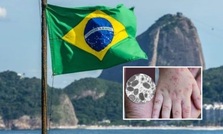 Confirman primera muerte por viruela del mono en Brasil