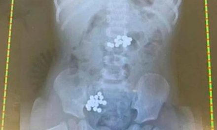 Niña muere en Saltillo por ‘comer’ imanes… la Pronnif ya investiga