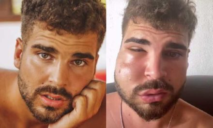 Influencer queda deforme tras acudir al dentista en México: tardó ‘30 segundos’ en verle la boca (video)