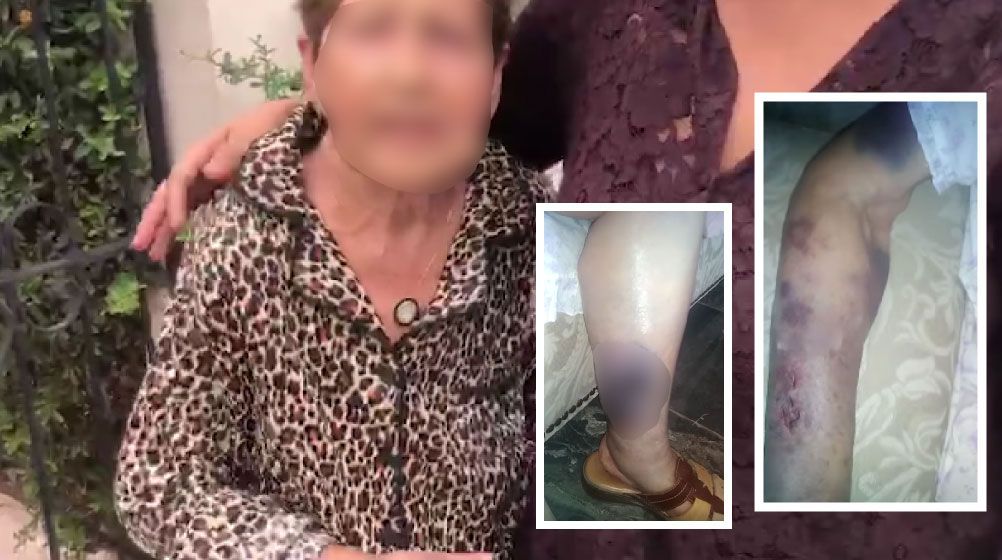 Iban a festejar Día del Adulto Mayor y encuentran golpeada a su abuela en asilo de Saltillo; ya fue clausurado (video)