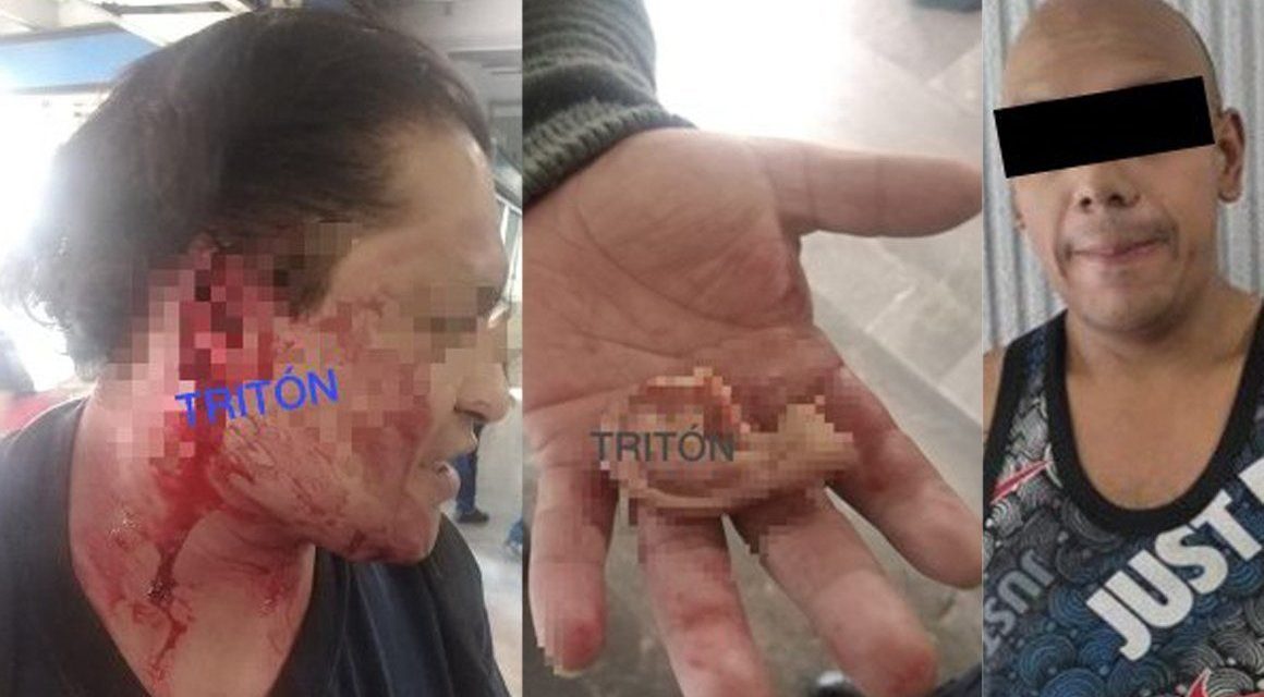 Hombre se cree Mike Tyson y le arranca la oreja a un usuario en el metro de la CDMX