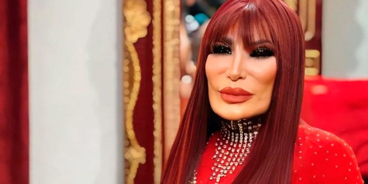 Lyn May presume nuevo rostro tras cirugía a sus 70 años