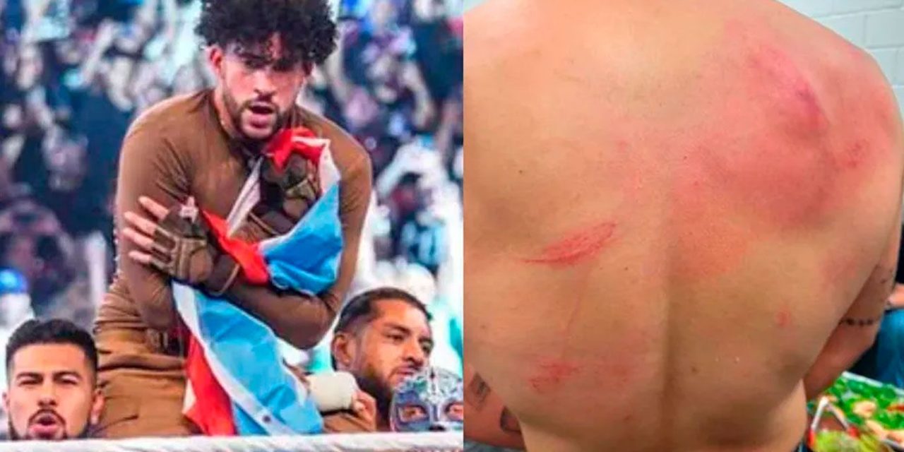 Así le quedó la espalda a Bad Bunny tras pelea en WWE