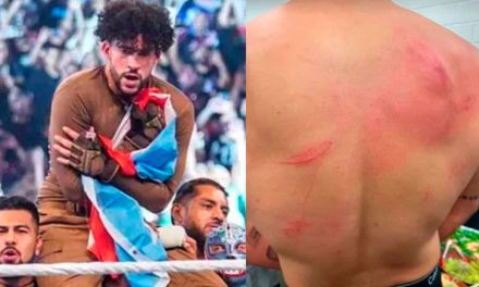 Así le quedó la espalda a Bad Bunny tras pelea en WWE