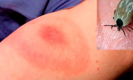 Rickettsiosis letal: mueren dos de cada 3 personas contagiadas