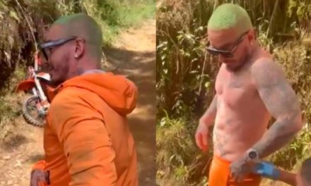 J Balvin sorprende a sus fans mostrando sus heridas tras accidente