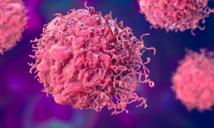 OMS alerta que los casos de cáncer aumentarán en 77% para 2050