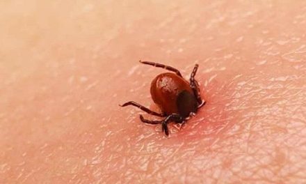 Se registra una muerte por rickettsia en la Región Sureste