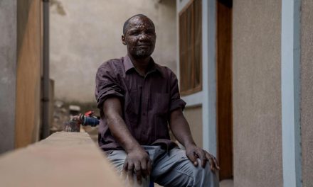 Africa registra más de 18,900 casos y 540 decesos por mpox o viruela del mono