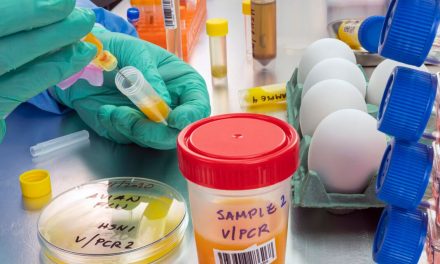 Detectan el primer caso sospechoso de gripe aviar H5 en humanos en Canadá