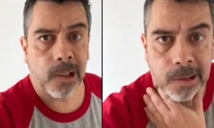 Carlitos Espejel aparece con parálisis facial… todo por culpa del estrés