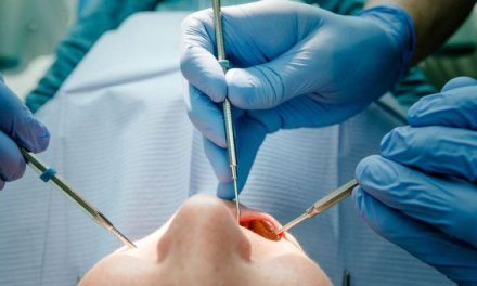 Joven aprendió a ser dentista en tutoriales de internet y termina detenido por atender pacientes