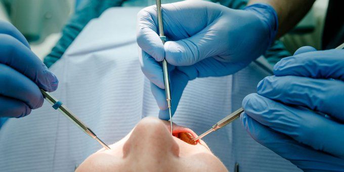 Joven aprendió a ser dentista en tutoriales de internet y termina detenido por atender pacientes