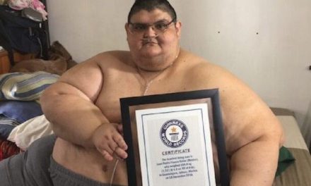Fallece Juan Pedro Franco, el mexicano que llego a pesar más de 500 kilogramos