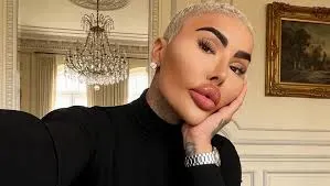 Pierde la vida James Parke, el influencer que se quería parecer a Kim Kardashian