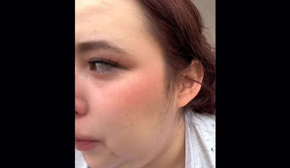 ‘Me decían que por cualquier cosa hacemos escándalo’; mujer denuncia malos tratos de policía ante intento de feminicidio